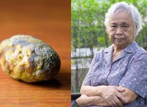 Photo of पेट दर्द की शिकायत लेकर अस्पताल पहुंचीं दादी, आल्ट्रासाउंड में दिखी खौफनाक चीज