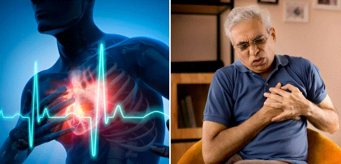 Photo of Heart Attack आने पर खांसी से भी बचा सकते हैं अपनी जान
