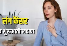 Photo of मामूली लगने वाली ये छोटी-छोटी परेशानियां करती हैं Lung Cancer का इशारा