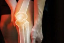 Photo of ये 5 लक्षण दिखें तो समझ जाएं हो गया है Bone Cancer