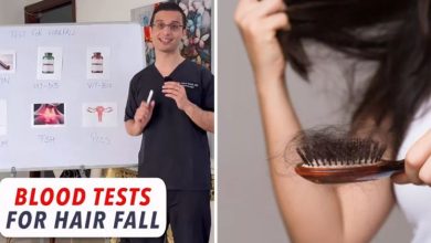 Photo of हेयर फॉल से परेशान हैं, तो जरूर करवा लें ये 6 Blood Tests