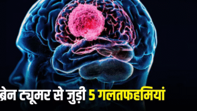 Photo of  डॉक्टर ने बताई ब्रेन ट्यूमर से जुड़े 5 मिथकों की सच्चाई