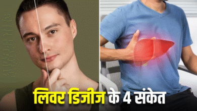 Photo of Liver Disease का संकेत हो सकते हैं स्किन में नजर आने वाले 4 बदलाव
