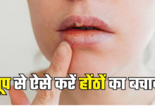 Photo of आपके होंठों को झुलसा सकती है चिलचिलाती धूप, इन उपायों से करें Lips की देखभाल