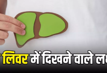 Photo of रात में नजर आते हैं Fatty Liver के ये 6 लक्षण