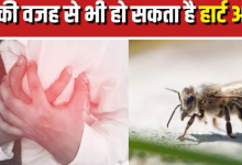 Photo of क्या किसी एलर्जी के कारण भी आ सकता है Heart Attack? आइए जानें क्या कहते हैं डॉक्टर