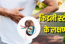 Photo of दिखने लगें ये 6 लक्षण, तो समझ जाएं हो गई है किडनी में पत्थरी