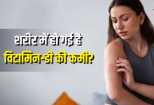 Photo of स्किन पर दिखने वाले ये 6 लक्षण करते हैं विटामिन-डी की कमी का इशारा