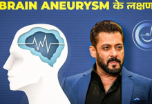 Photo of क्या है Brain Aneurysm, जिससे जूझ रहे हैं बॉलीवुड एक्‍टर Salman Khan