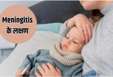 Photo of क्या होती है Meningitis बीमारी? इन लक्षणों से करें पहचान