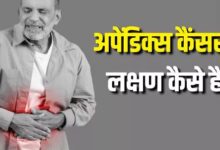 Photo of मिलेनियल्स में तेजी से बढ़ रहे हैं Appendix Cancer के मामले