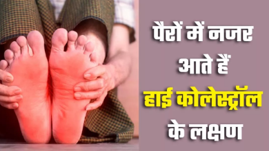 Photo of रात होते ही पैरों में नजर आते हैं हाई कोलेस्ट्रॉल के 4 संकेत