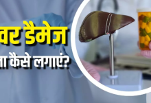 Photo of डॉक्टर ने बताए 4 सिंपल होम टेस्ट, जो बता देंगे आपके लिवर का हाल