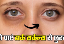 Photo of आंखों के नीचे आ गए हैं काले घेरे, तो इन 5 टिप्स से पाएं जिद्दी डार्क सर्कल्स से छुटकारा