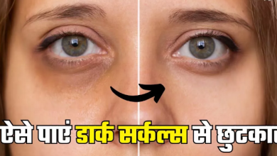 Photo of आंखों के नीचे आ गए हैं काले घेरे, तो इन 5 टिप्स से पाएं जिद्दी डार्क सर्कल्स से छुटकारा