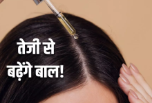 Photo of लंबे और मजबूत बालों के लिए घर पर बनाएं ये Hair Growth Serum, डैंड्रफ की समस्या भी होगी दूर