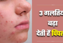 Photo of पिंपल्स से छुटकारा पाने के चक्कर में आप तो नहीं कर रहे 3 गलतियां?