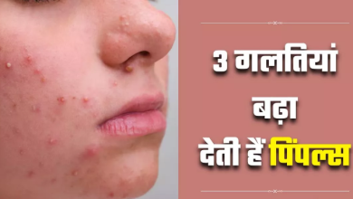 Photo of पिंपल्स से छुटकारा पाने के चक्कर में आप तो नहीं कर रहे 3 गलतियां?