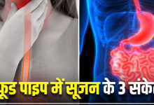 Photo of 3 लक्षण देखकर समझ जाएं फूड पाइप में हो गई है सूजन