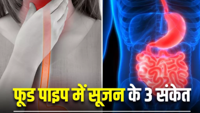 Photo of 3 लक्षण देखकर समझ जाएं फूड पाइप में हो गई है सूजन
