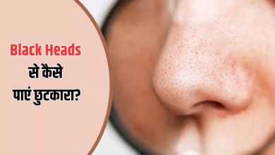Photo of Black Heads हटाने के लिए आजमाएं 4 नुस्‍खे