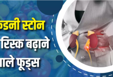 Photo of किडनी में पथरी का खतरा बढ़ा देते हैं ये 10 फूड्स