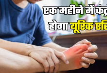 Photo of एक महीने में बढ़ा हुआ Uric Acid होगा नेचुरली कंट्रोल, बस आज से ही अपना लें 7 टिप्स
