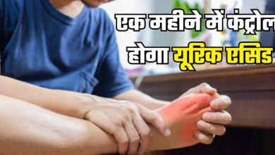 Photo of एक महीने में बढ़ा हुआ Uric Acid होगा नेचुरली कंट्रोल, बस आज से ही अपना लें 7 टिप्स