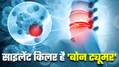 Photo of दर्द, सूजन और गांठ… कहीं शरीर में चुपचाप तो नहीं पनप रहा Bone Tumor?