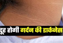 Photo of गर्दन पर जमा कालापन दूर करने में मदद करेंगे 5 टिप्स