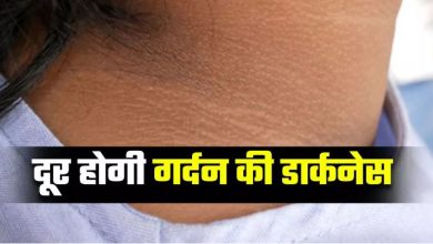 Photo of गर्दन पर जमा कालापन दूर करने में मदद करेंगे 5 टिप्स