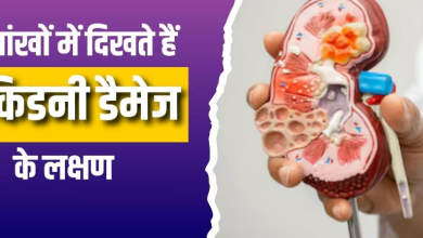 Photo of आंखों में दिखने वाले ये 4 लक्षण करते हैं किडनी डैमेज का इशारा