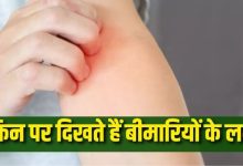 Photo of स्किन पर होने वाले ये 6 बदलाव करते हैं गंभीर बीमारियों का इशारा