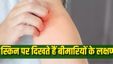Photo of स्किन पर होने वाले ये 6 बदलाव करते हैं गंभीर बीमारियों का इशारा