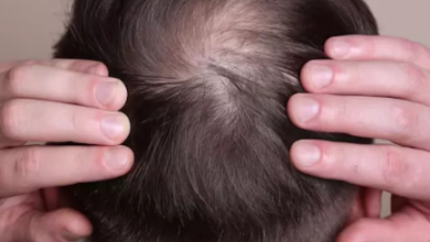 Photo of कहीं किसी बीमारी से तो नहीं झड़ रहे आपके बाल?
