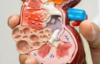 Photo of किडनी डैमेज की शुरुआत में दिखते हैं ये 8 लक्षण, नजरअंदाज करने से बढ़ जाएगी समस्या