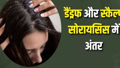 Photo of सिर में होने वाली खुजली सिर्फ डैंड्रफ है या स्कैल्प सोरायसिस का संकेत?