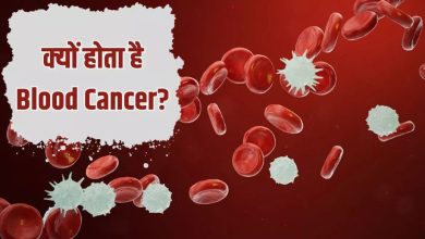 Photo of उम्र, स्मोकिंग या लाइफस्‍टाइल, किन वजहों से बढ़ता है Blood Cancer का खतरा? 