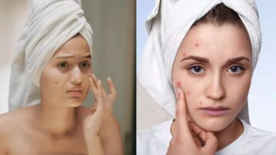 Photo of ब्‍लैकहेड्स और व्‍हाइट हेड्स इनसे कैसे पाएं छुटकारा?