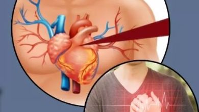 Photo of हार्ट अटैक से बचने के लिए इन 5 गंभीर लक्षणों को समय रहते पहचानें