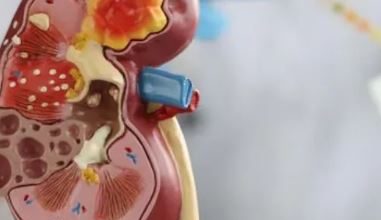 Photo of किडनी डैमेज होने पर सुबह दिखते हैं ये 5 लक्षण