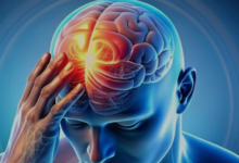 Photo of तनाव और वायु प्रदूषण से बढ़ रहा स्ट्रोक का खतरा