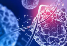 Photo of कैंसर के शुरुआत में नजर आते हैं ये 5 लक्षण