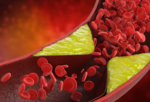 Photo of जीन एडिटिंग थेरेपी से खराब कोलेस्ट्रॉल में आएगी कमी