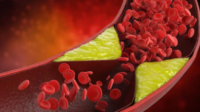 Photo of जीन एडिटिंग थेरेपी से खराब कोलेस्ट्रॉल में आएगी कमी