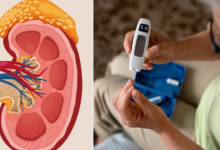 Photo of डायबिटीज रोगी हो जाएं सावधान, शुगर कंट्रोल नहीं तो आपकी किडनी भी खतरे में