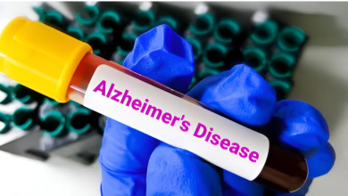 Photo of लक्षण दिखने से 10 साल पहले ही पता चल सकेगा अल्जाइमर का खतरा