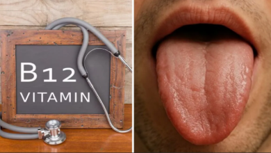 Photo of जीभ पर दिखते हैं विटामिन-B12 की कमी के 3 बड़े संकेत