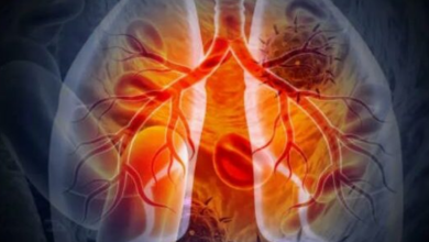 Photo of फेफड़ों के कैंसर के खिलाफ बड़ी कामयाबी