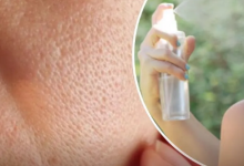 Photo of ओपन पोर्स ने छीन ली है चेहरे की खूबसूरती, आज ही ट्राई करें 5 ‘नेचुरल’ टोनर